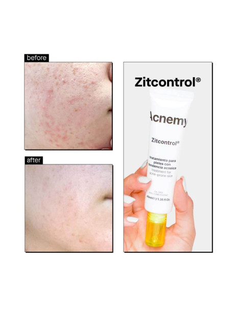 Acnemy Zitcontrol Крем для проблемної шкіри