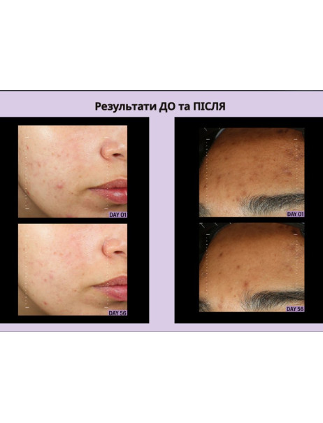 Allies Of Skin Azelaic & Kojic Advanced Clarifying Serum Сироватка освітлююча з азелаїновою кислотою