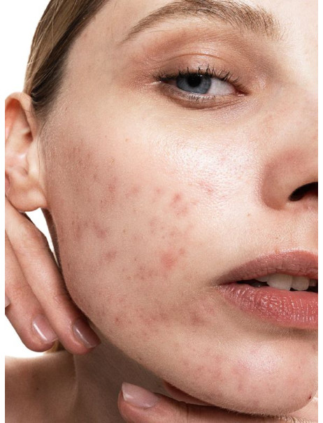 Allies of Skin Promise Keeper Nightly Blemish Treatment Нічна маска для обличчя знижка