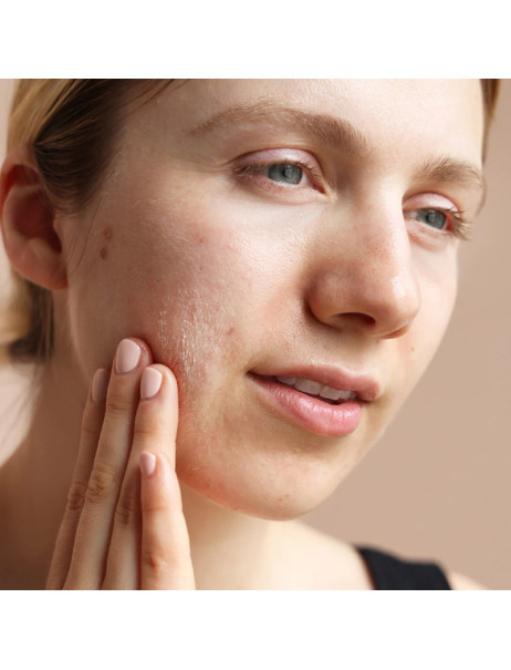 Bioelements Pore Thing Очищуючий гель для шкіри з акне з саліциловою та азелаїновою кислотами