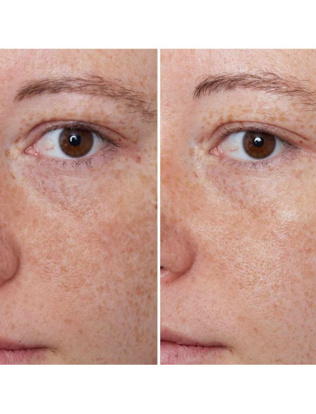 By Terry Hyaluronic Global Face Cream Крем для лица