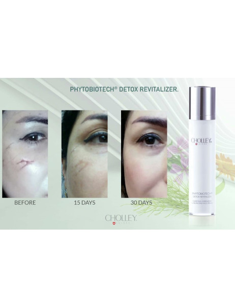 Cholley Phytobiotech Detox Revitalizer Детокс ревіталайзер