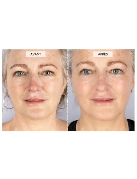 CurrentBody Skin LED Face & Neck Mask Kit Маска для LED-терапии омоложения лица и шеи