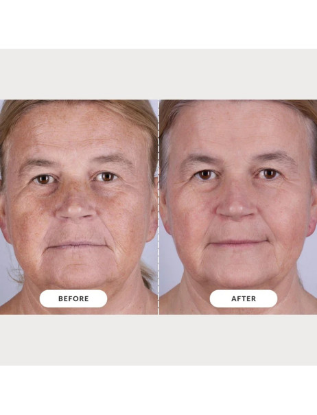 CurrentBody Skin LED Light Therapy Face Mask Series 2 Маска для LED-терапии омоложения и обновления кожи