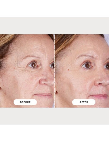 CurrentBody Skin LED Light Therapy Face Mask Series 2 Маска для LED-терапии омоложения и обновления кожи