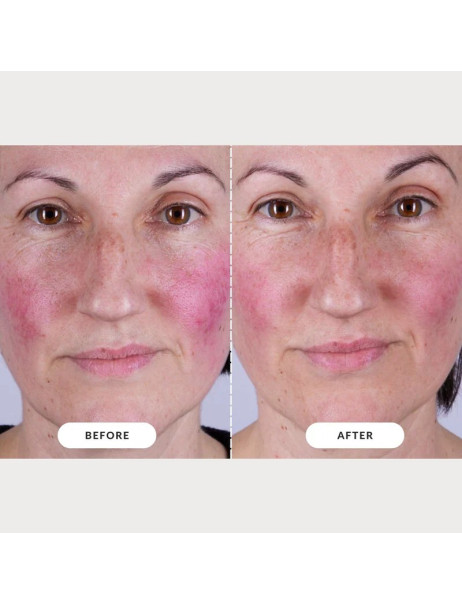 CurrentBody Skin LED Light Therapy Face Mask Series 2 Маска для LED-терапии омоложения и обновления кожи