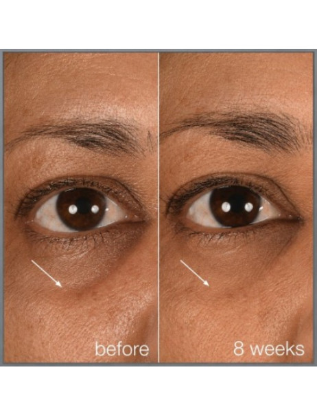 Dermalogica Smart Eye Density Serum Сыворотка-альтернатива филерам для зоны вокруг глаз