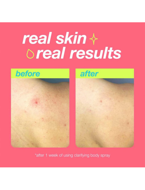 Dermalogica Clear Start Clarifying Body Spray Спрей для тела против высыпаний и акне