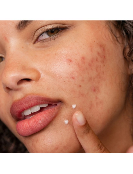 Dermalogica Clear Start Post Breakout Fix Гель-крем для лікування плям після висипань