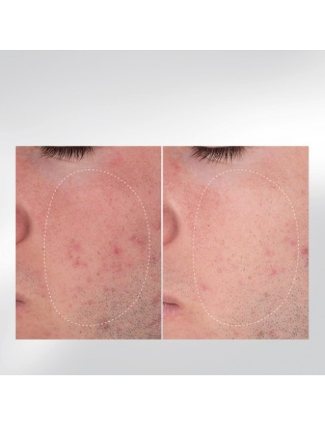 Dermalogica Your Moment Of Expertise Догляд для експертної досконалості