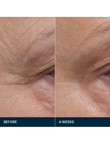 Elemis Pro-Collagen Future Restore Serum Досконала зміцнююча сироватка