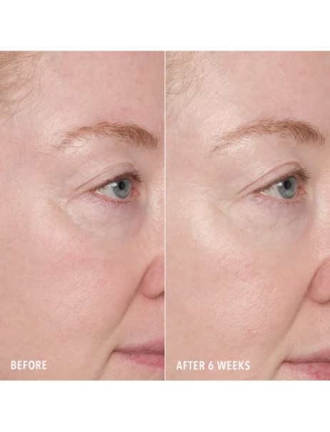 Омолоджувальний пілінг HydroPeptide 5X Power Peel