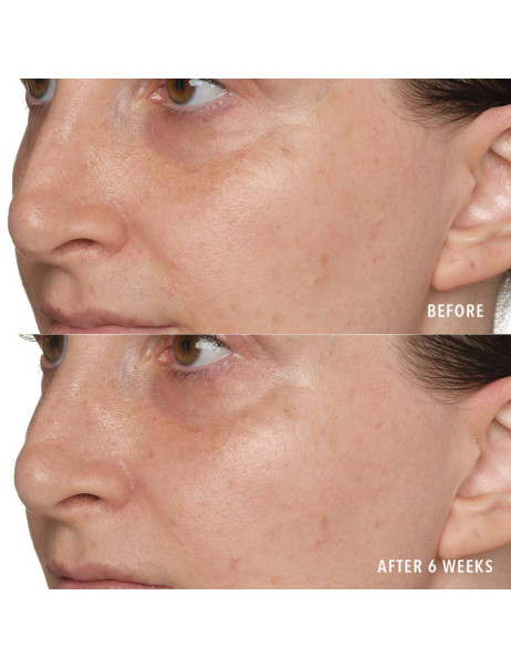 Омолоджувальний пілінг HydroPeptide 5X Power Peel
