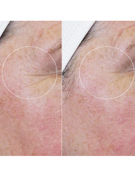 HydroPeptide Daily Drench Пептидный бустер с гиалуроновой кислотой