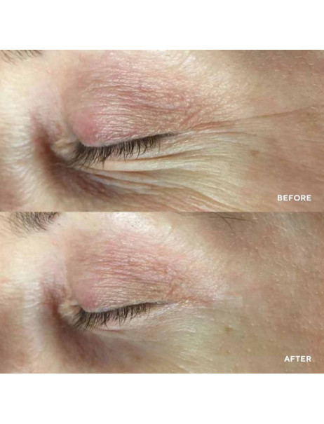 HydroPeptide PolyPeptide Collagel + Mask for eyes Патчі для зони навколо очей