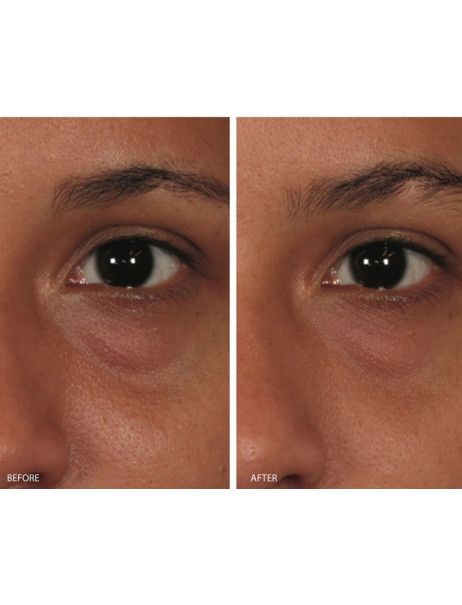 Image Skincare Ormedic Balancing Eye Lift Gel Лифтинговый крем-гель для век