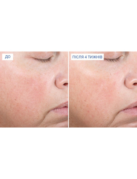 iS Clinical Extra Strength Active Peel Brightening System Пілінг-система для освітлення, оновлення та зменшення зморшок