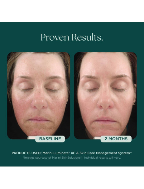 Jan Marini Luminate XC Face Lotion Лосьон для осветления кожи