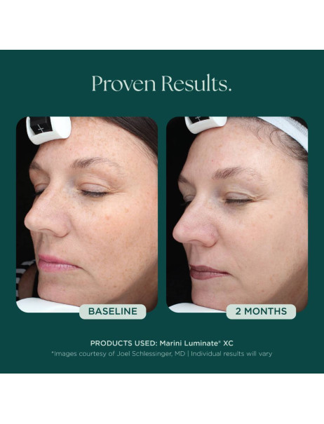 Jan Marini Luminate XC Face Lotion Лосьон для осветления кожи