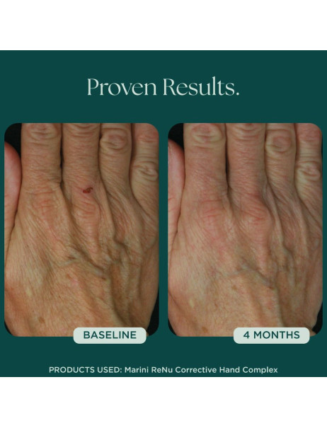 Jan Marini ReNu Corrective Hand Complex Антивозрастной крем для рук