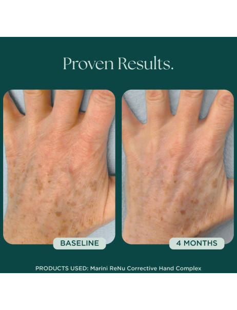 Jan Marini ReNu Corrective Hand Complex Антивозрастной крем для рук
