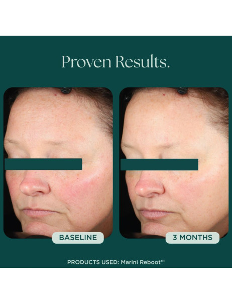 Jan Marini Reboot PDRN Face Serum Сыворотка для лица с полинуклеотидами