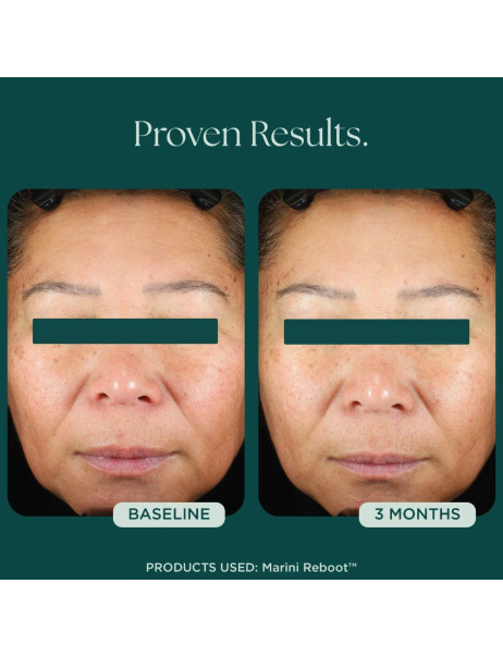 Jan Marini Reboot PDRN Face Serum Сыворотка для лица с полинуклеотидами