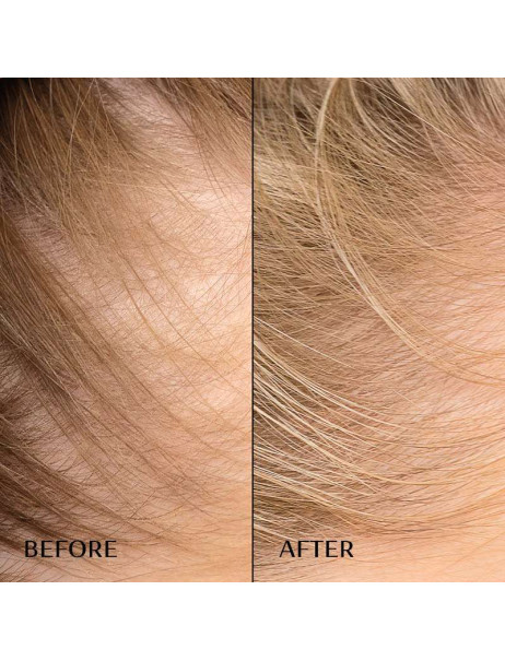 M2 Beaute Hair Activating Serum Сыворотка-бустер против выпадения волос
