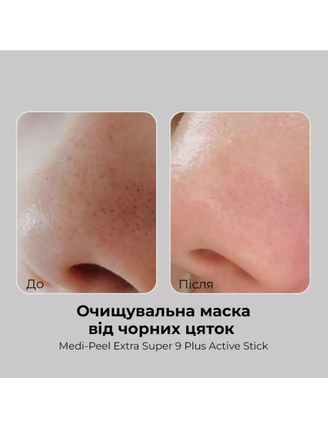 Medi-Peel Extra Super 9 Plus Blackhead Out Nose Pack Двоступенева маска від чорних цяток