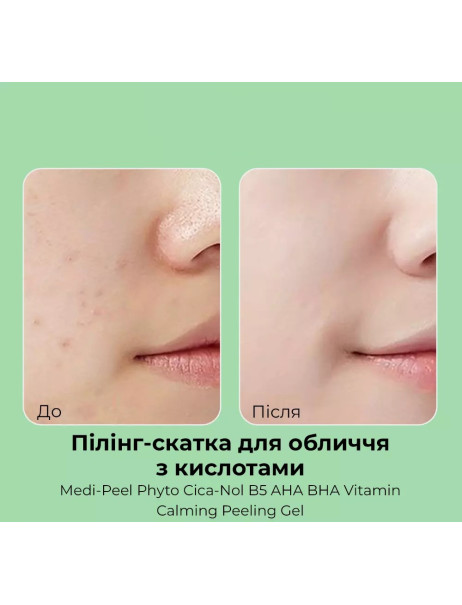 Medi-Peel Phyto Cica-Nol B5 Calming Peeling Gel Заспокійливий пілінг-гель з центеллою