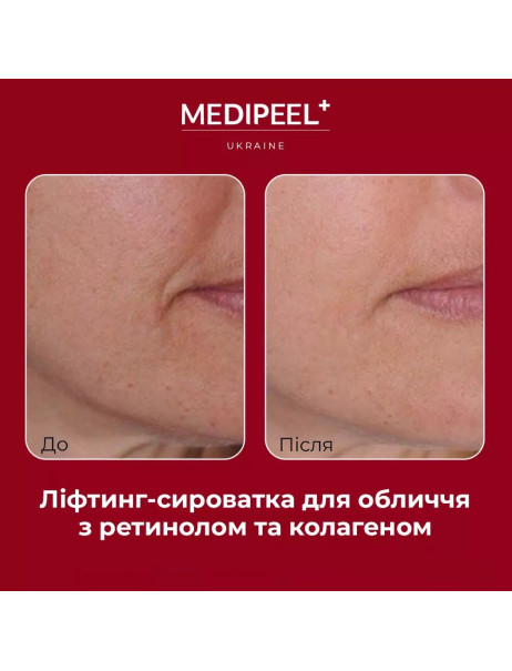 Medi-Peel Retinol Collagen Lifting Ampoule Лифтинг-ампула для лица с ретинолом и коллагеном