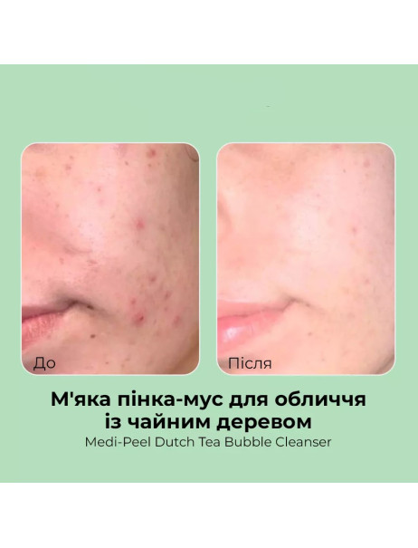 Medi-Peel Dutch Tea Bubble Cleanser Пенка-мусс для умывания