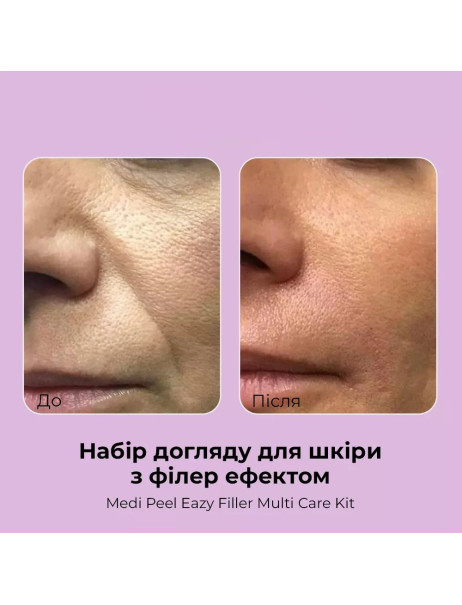 Medi-Peel Eazy Filler Multi Care Kit Набір мініатюр для обличчя
