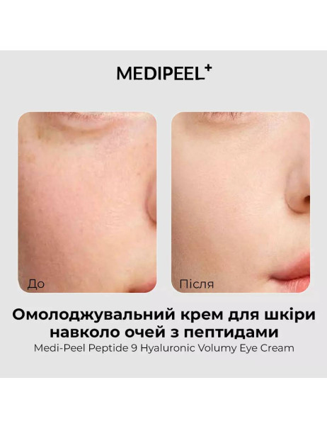 Medi-Peel Peptide Balance9 Eye Hyaluronic Volumy Eye Cream Омолоджуючий крем для повік з пептидами