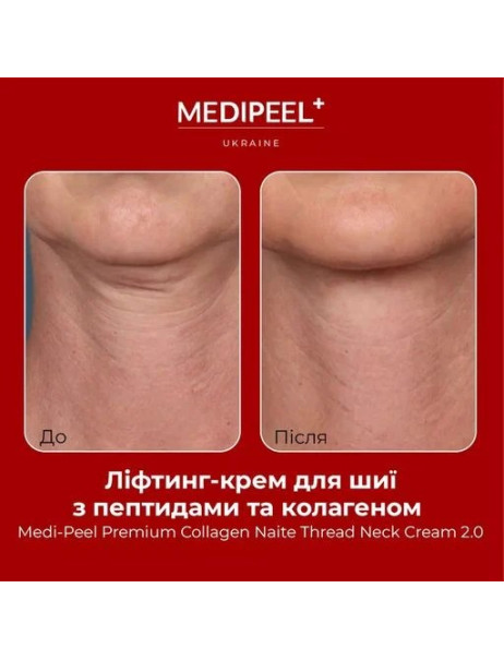 Medi-Peel Premium 2.0 Collagen Naite Thread Neck Cream Пептидний крем для шиї та декольте