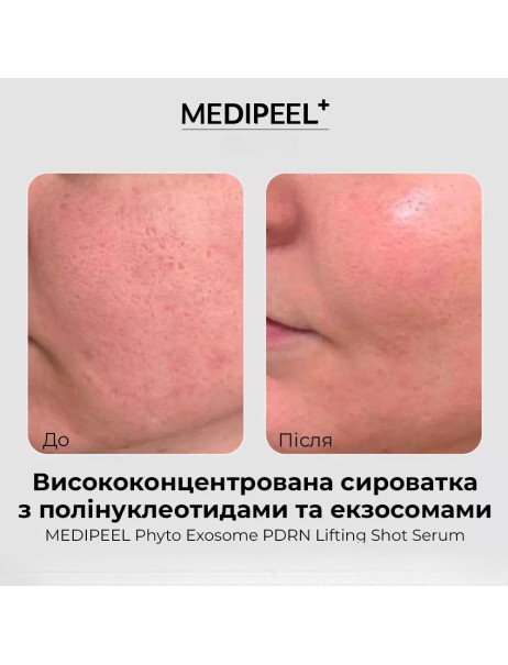 Medi-Peel Phyto PDRN Exosome Lifting Shot Serum Сироватка з екзосомами та полінуклеотидами