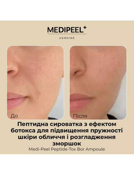 Medi-Peel Bor-Tox Peptide Ampoule Лифтинг-ампула с пептидним комплексом