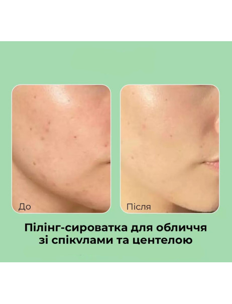 Medi-Peel Phyto Cica-Nol B5 6000 Shot Serum Пілінг-сироватка зі спікулами та центелою