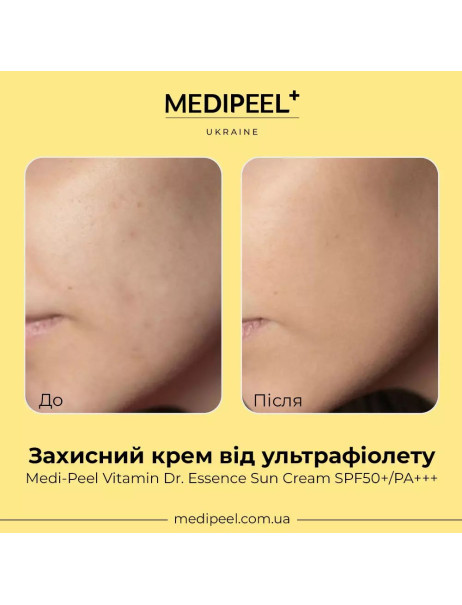 Medi-Peel Vitamin Dr. Essence Sun Cream SPF50+/PA++++ Сонцезахисний крем