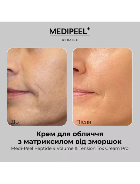 Medi-Peel Peptide 9 Volume and Tension Tox Cream Pro Крем з пептидами