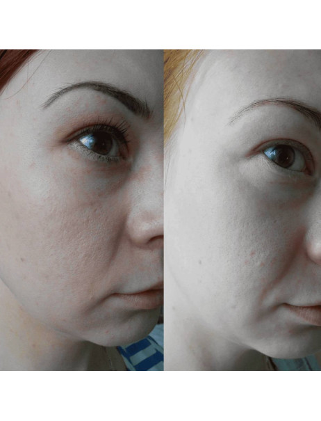 Medica+ Antibacterial Suspension Суспензия для лица