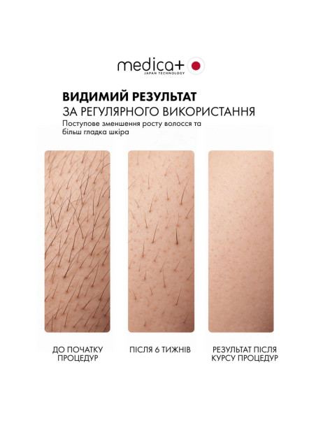 Medica+ Ice Pro 10X Фотоепілятор охолоджуючий