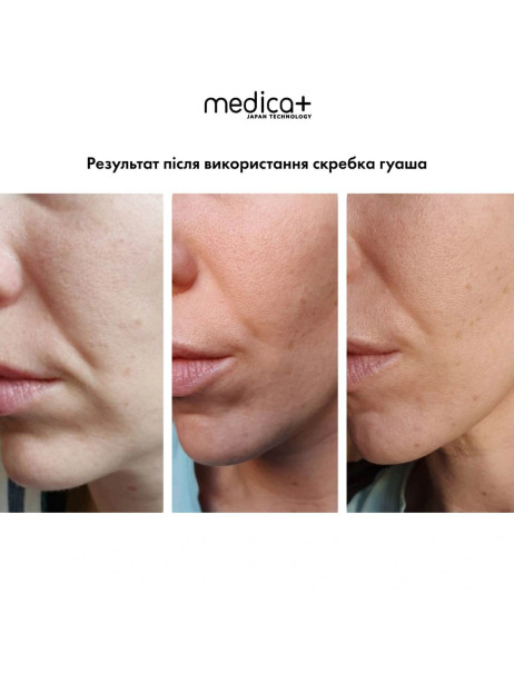 Medica+ Steel GuaSha Сталевий скребок гуаша для моделювання овалу обличчя