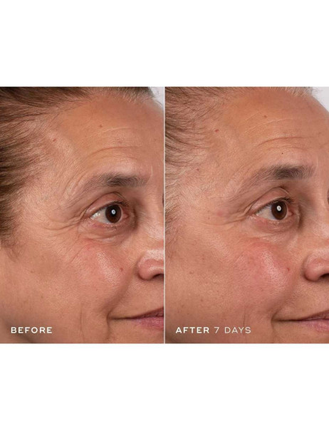 Medik8 Advanced Pro-Collagen+ Peptide Cream Омолоджувальний зволожувальний крем від зморшок із фактором росту MiniProtein™ та бустером довголіття NAD+