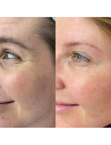 Mesonia Eye Contour Cream-Fluid Крем-флюїд для шкіри навколо очей