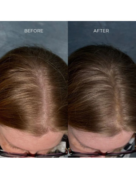 Nanogen Keratin Hair Fibres Волокна для потовщення волосся