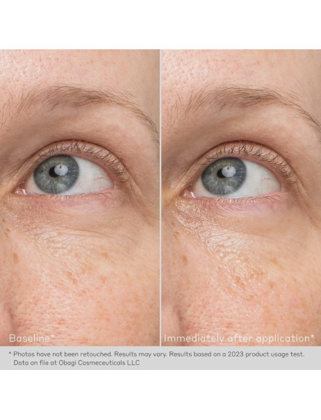Obagi Daily Hydro-Drops Rejuvenating Eye Gel Cream Відновлюючий гель-крем для контуру очей з олією гібіскусу та ніацинамідом