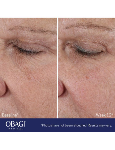 Obagi ELASTIderm Lift Up & Sculpt Facial Moisturizer Скульптуруючий зволожуючий крем для моделювання овалу обличчя з ефектом 3D ліфтингу