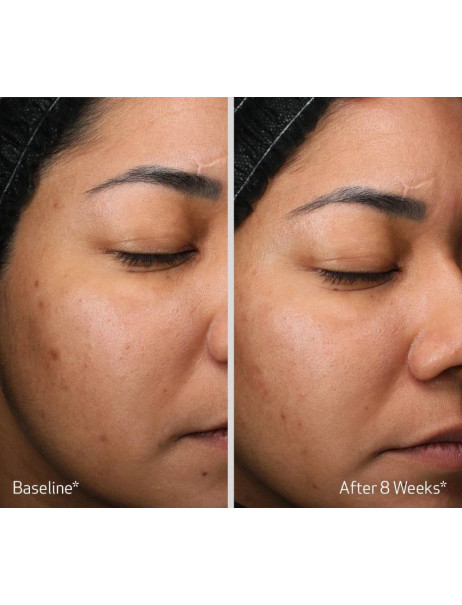 Obagi Retinol + PHA Refining Night Cream Восстанавливающий ночной крем с ретинолом и РНА-кислотами