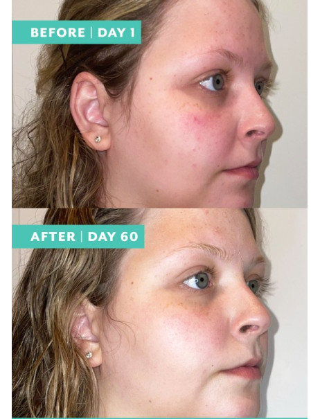 Patchology Skincare Booster Firm + Smooth Невидимый скин-бустер